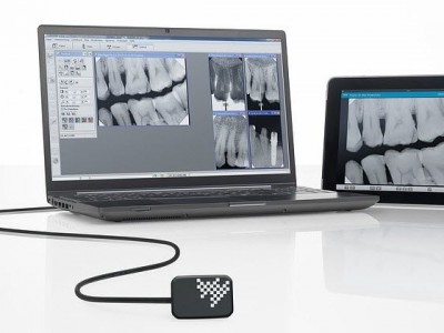 Digital Intra Oral Radiography